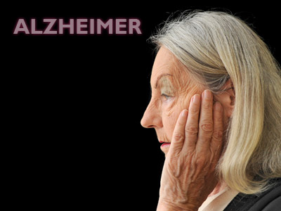 Photo of Alzheimer’in sırrı çözüldü