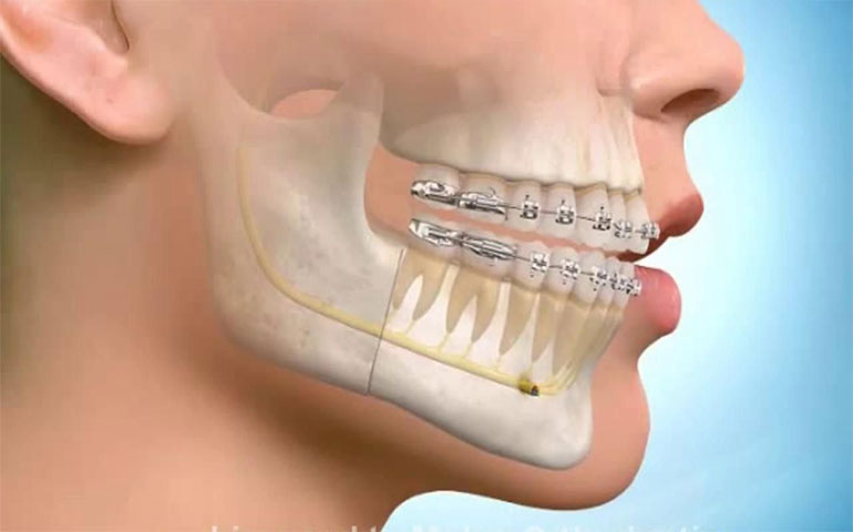 Photo of Ortodonti