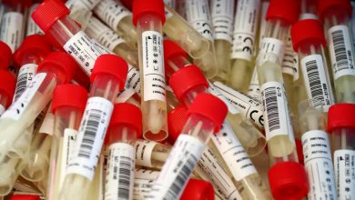 Photo of Korona testleri, ikinci doz aşı bekleyenlere ücretsiz olacak